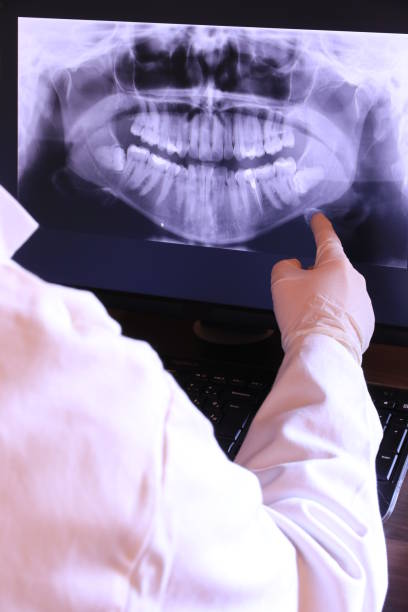 Best Emergency Tooth Extraction in Gray, LA
